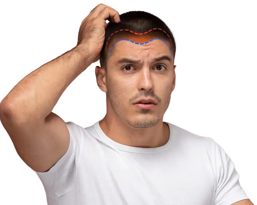 “AI in everyday life: Google WeatherNext 2 and MyHair AI improving weather forecasts and hair-loss treatment”